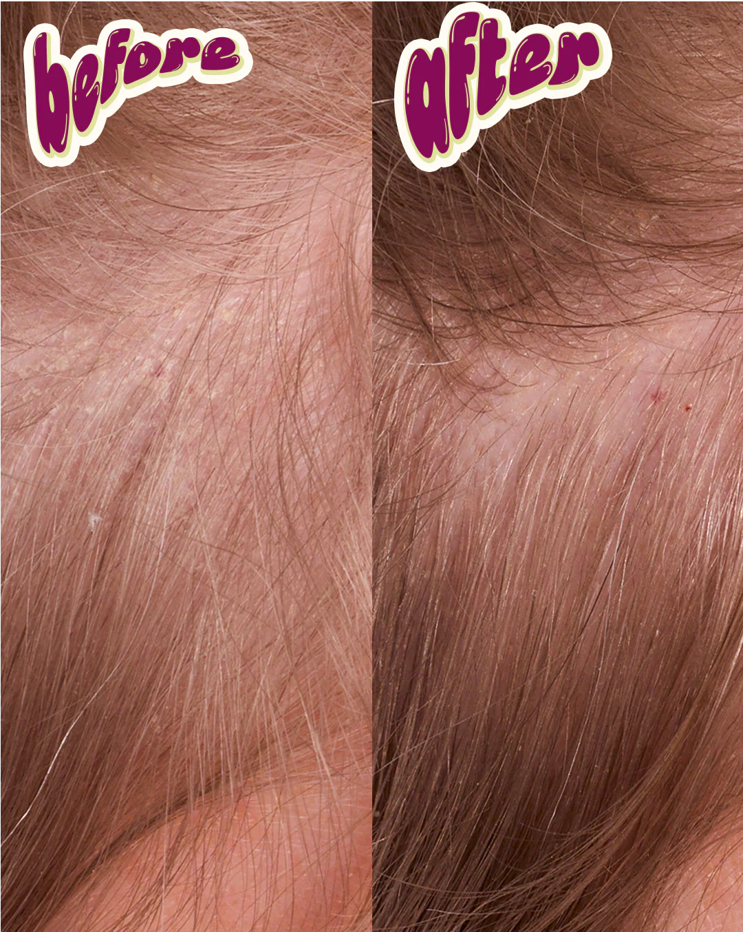 Coconut & Tea Tree Scalp & Hair Oil - Image 5